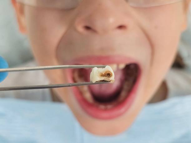 Best Tooth Pain Emergency Relief  in Grandview, WA